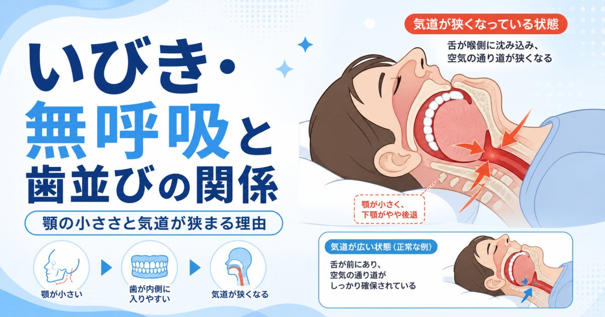 いびきや無呼吸は歯並びのせい？顎の小ささと気道が狭まる理由を解説